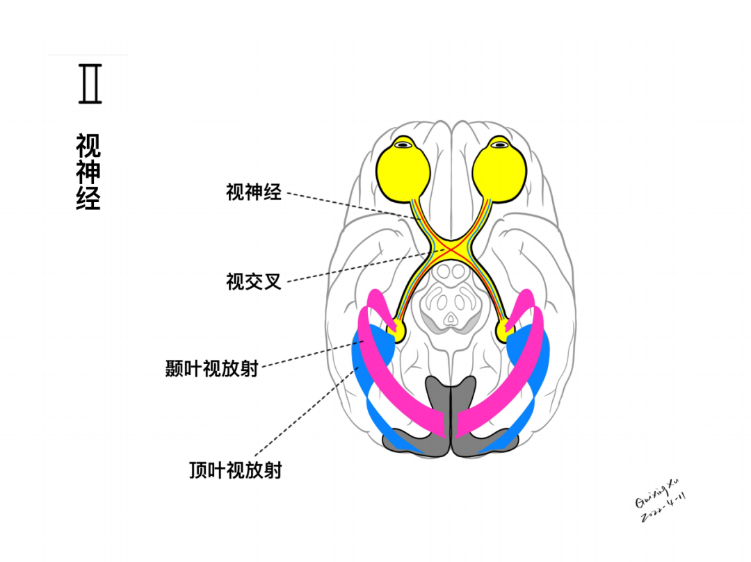 徐桂兴手绘：II 视神经及损伤后表现-医博网